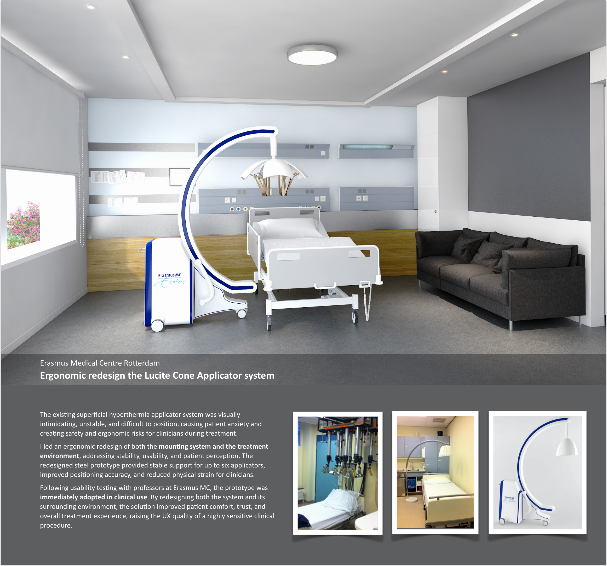 Ergonomic redesign the Lucite Cone Applicator system