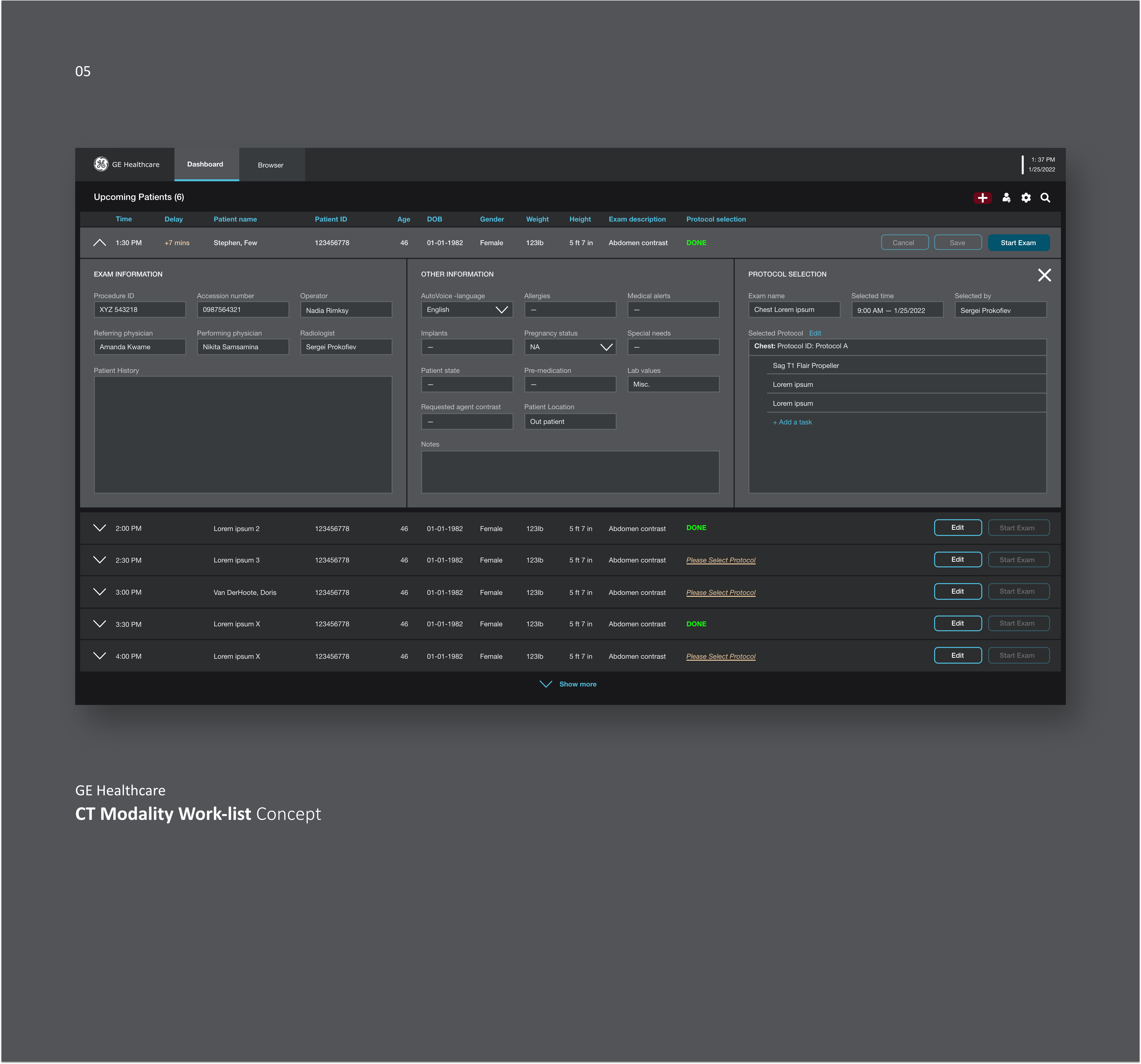 GE CT Modality Work-list Concept